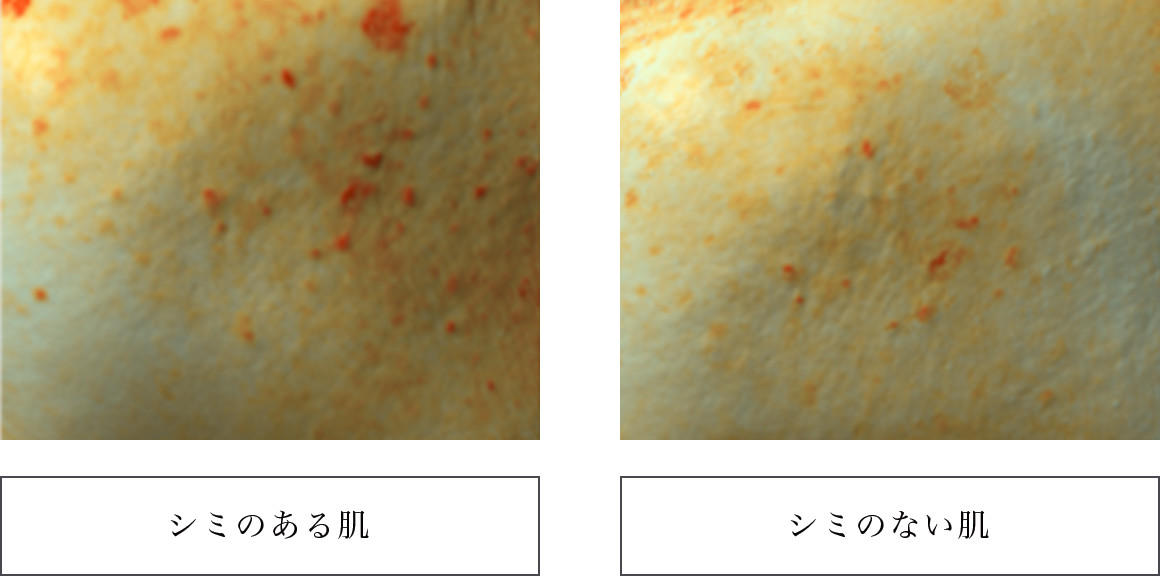 シミのある肌・ない肌